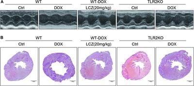 LCZ696 Attenuated Doxorubicin-Induced Chronic Cardiomyopathy Through the TLR2-MyD88 Complex Formation